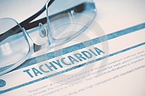 Tachycardia. Medicine. 3D Illustration.