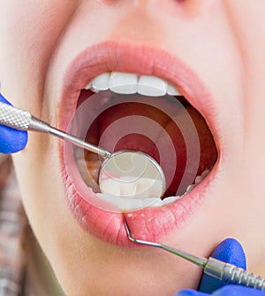 Taking care of teeth. Woman at the dentist. Dental care, taking care of teeth. Girl having teeth examined at dentists