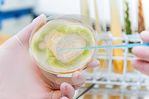 Taking microbiological samples