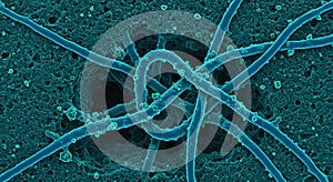 Tangle of threadlike microbes on cellular surface