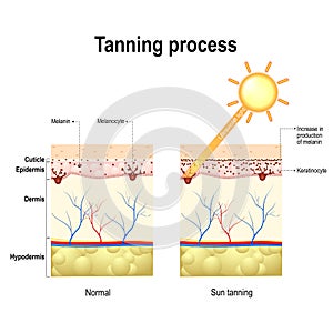 Tanning process. Skin. Human anatomy