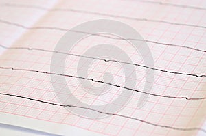 Tape ECG with ventricular asystole