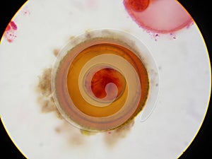 Tapeworm (Taenia) egg