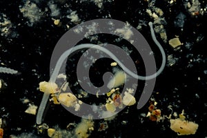 Tapeworms (Cestoda: Caryophyllidea), Parasites of Fish under the microscope for education