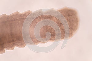 Tapeworms (Cestoda: Caryophyllidea), Parasites of Fish under the microscope for education