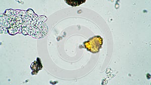 The tardigrade is walking near the colony of green algae in magnification