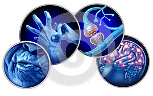 Tardive Dyskinesia TD photo