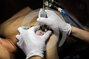 Tattooing