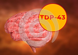 TDP-43, TAR DNA binding protein 43, is a biochemical marker of neurodegenerative diseases