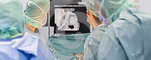 Team of doctor perform total hip arthroplasty replacement surgery in osteoarthritis patient inside the operating room. mako robot-