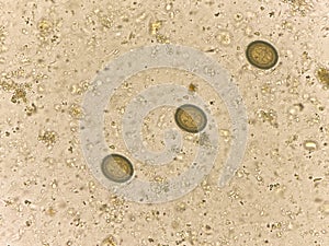 Teania egg human parasite in stool