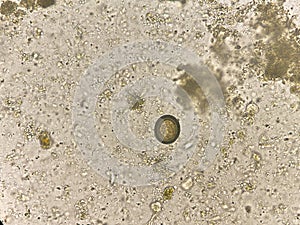 Teania egg human parasite in stool