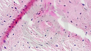 Teased human tendon in cross section magnified under microscope in 400 times on bright field
