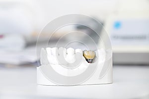 Technical shots on a dental prothetic laboratory photo