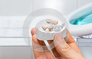 Technical shots of model on a dental prothetic laboratory