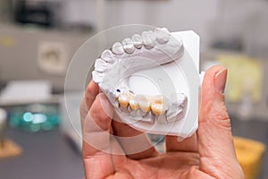 Technical shots of model on a dental prothetic laboratory photo