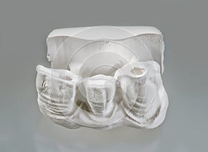 Technical shots of plaster model on a dental prothetic laboratory photo
