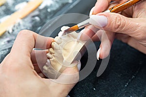 Technician in a dental laboratory applying ceramics to a prosthesis