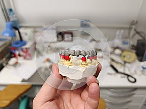 Technician dental is working with complete lower and upper metal ceramic prosthesis dental.