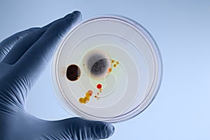 Technician hand holding petri dish with microbes culture in the
