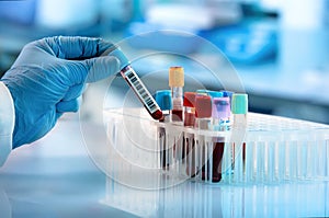 Technician holding blood tube test in the research laboratory