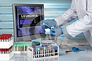 Technician in lab examining blood sample with Leukemia disease r