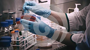 Technician with loop and petri dish in the laboratory / hand of Doctor making a urine culture in a petri dish