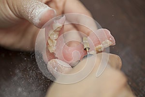 Technician make denture prothesis in dental laboratory