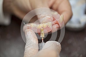 Technician make denture prothesis in dental laboratory photo