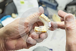 Technician Working On 3D Printed Mold For Dental Implants