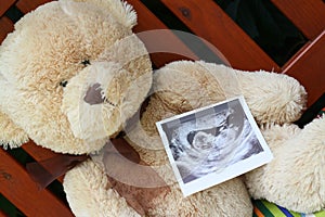 Teddy bear and baby ultrasound