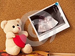 Teddy bear with an ultrasound photo pinned on cork