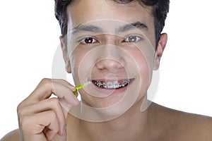 Teen boy wearing braces on white background