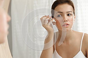 Teen girl with acne problem applying cream near mirror