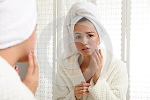 Teen girl with acne problem near mirror