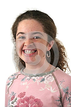 Teen Girl Before Braces