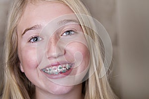 Teen girl with braces on her teeth