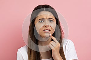 Teen Skin Problem. Upset Teenage Girl Touching Pimple On Her Face