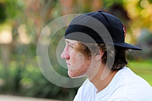 Teenage boy with acne and backwards baseball hat looking sideways