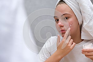 Teenage girl . Acne. Care for problem skin