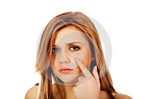 Teenage woman pointing on pimple on her cheek