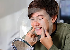 Teenager boy with diastema overbite teeth missing gap problem wearing orthodontic appliance treatment infront of the mirror.