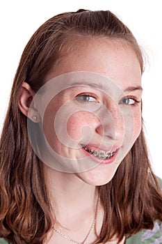 Teenager With Braces