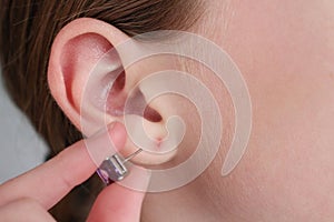 The teenager tore off his earlobe with an earring. The wound on the ear