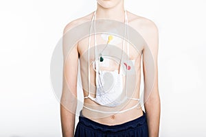 Teenager on white background with Holter on chest. Heart electrocardiogram or monitoring using Holter for young patient