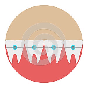 Teeth with braces icon dentist flat vector with long shadow sign. Symbol for mobile user