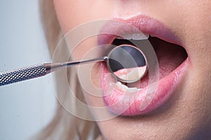 Teeth dentist mouth mirror close-up. Examination of teeth with dental mirror. Ideal teeth. Dental tools. Close up womans
