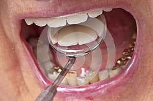 Teeth examination