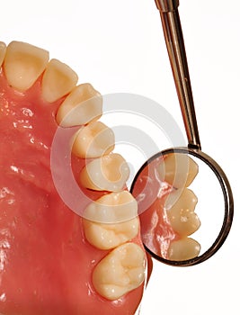 Teeth examined by dental mirror during checkup