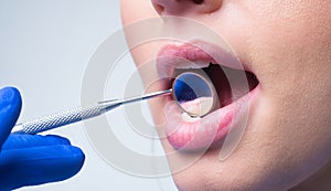 Teeth examined at dentists. Healthy woman teeth and a dentist mouth mirror. Ideal teeth. Dental tools. Close up womans
